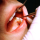 Fibromialgia: dolor de dientes y de mandíbula