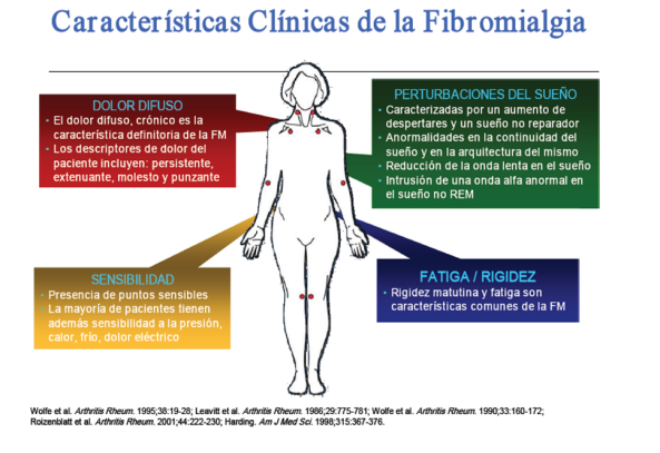 Fibromialgia clínica
