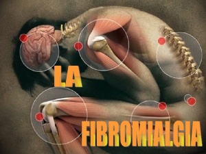 la-fibromialgia-1-728
